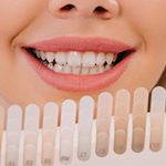 Clinicas dentales con blanqueamiento dental en Houston, Texas